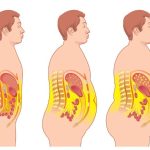 How to Get Rid of Visceral Fat