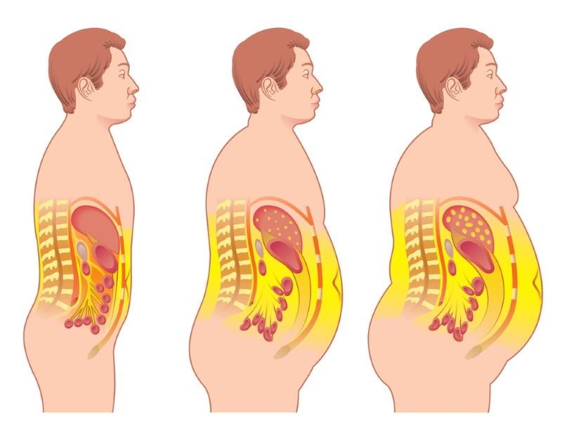 How to Get Rid of Visceral Fat