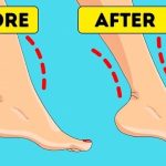 How To Get Rid Of Cankles