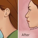 How To Get Rid Of Neck Fat Easily