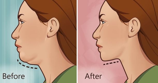 How To Get Rid Of Neck Fat Easily