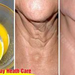 Mix These 3 Ingredients And Apply To The Neck Will Help Get Rid Of Wrinkles Quickly