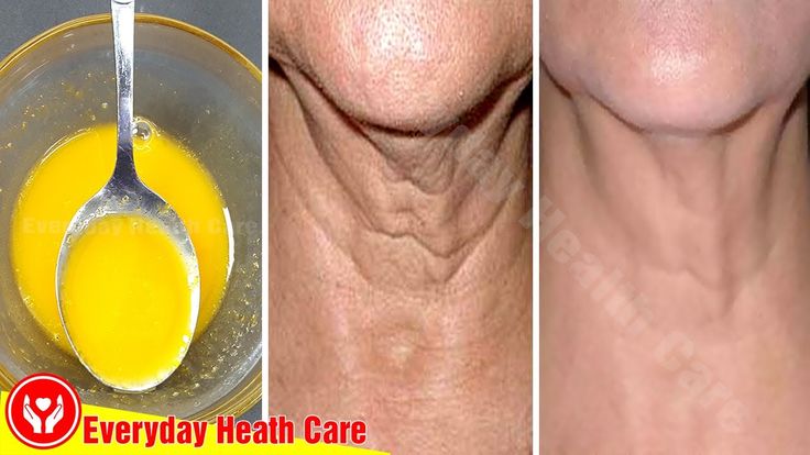 Mix These 3 Ingredients And Apply To The Neck Will Help Get Rid Of Wrinkles Quickly