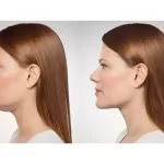 How to get rid of double chin using Gua Sha