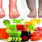 8 BEST HOME REMEDIES TO REDUCE WATER RETENTION