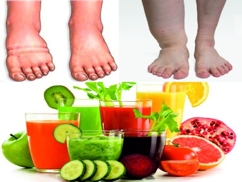 8 BEST HOME REMEDIES TO REDUCE WATER RETENTION