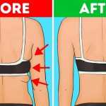 How To Get Rid Of Armpit Fat