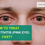 Home Remedies for Pink Eye: 8 Natural Remedies for Pink Eye that Work!