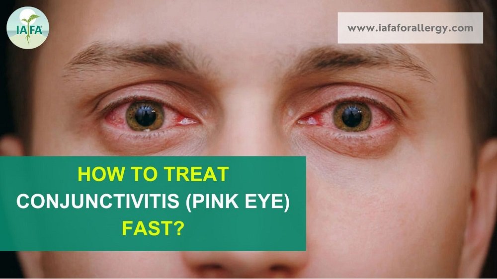 Home Remedies for Pink Eye: 8 Natural Remedies for Pink Eye that Work!