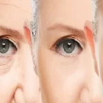 How To Look 10 Years Younger: Reverse the Signs of Aging, Get Rid of Wrinkles an