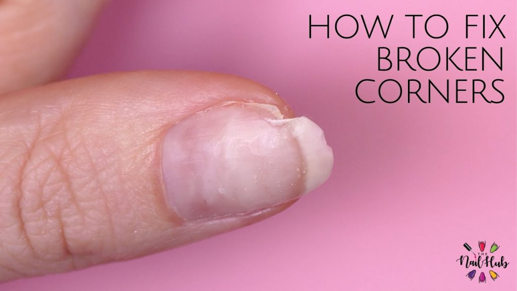 How To Fix A Broken Nail At Home: 5 Ways That Actually Work