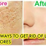 Minimize Pores Naturally: At-Home Remedies And Prevention Tips