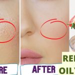 How To Get Rid Of Oily Skin At Home