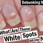 What Are White Spots On Nails And How To Get Rid Of Them?