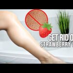 How To Get Rid Of Strawberry Legs In 5 Easy Steps