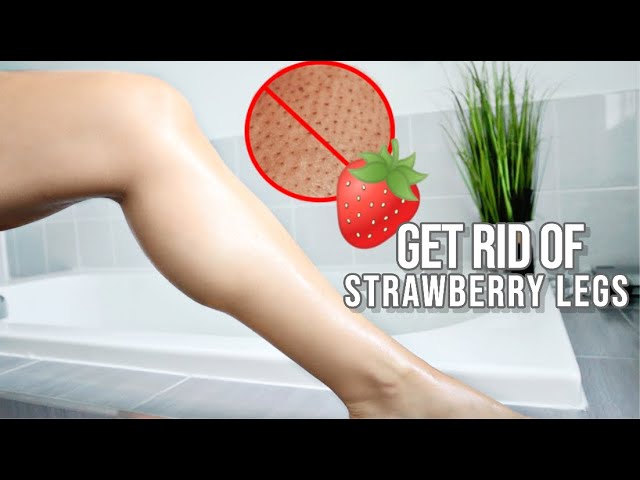 How To Get Rid Of Strawberry Legs In 5 Easy Steps