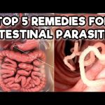 Stomach Parasites Symptoms [and how to get rid of them] – Quit Chronic Fatigue