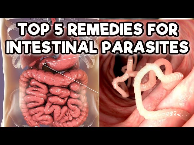 Stomach Parasites Symptoms [and how to get rid of them] – Quit Chronic Fatigue