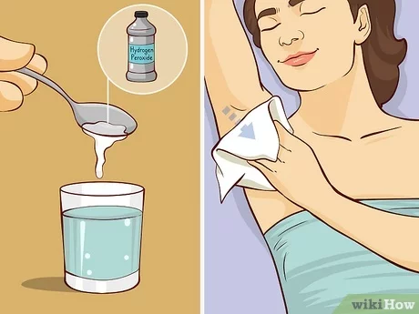 How To Get Rid Of Smelly Armpits