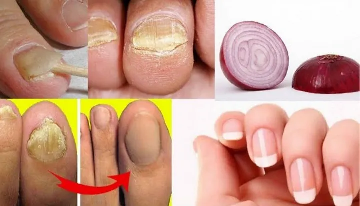 Genius Ideas That Will Change the Way You Paint Your Nails 💅✨