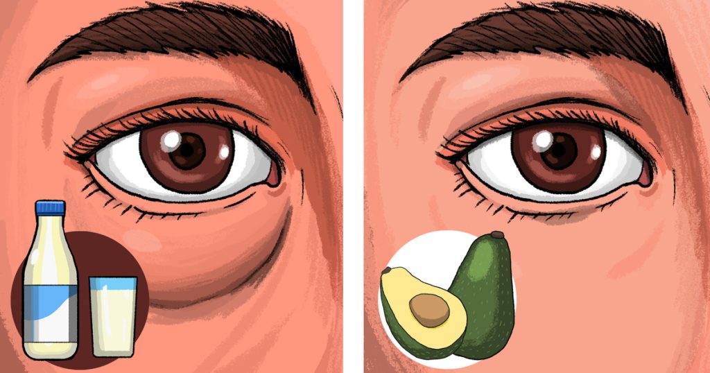 9 Foods That Make Your Eyes Puffy