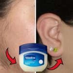 This Vaseline Trick Can Help You Remove Unwanted Hair