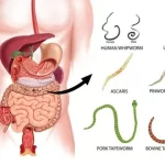 Stomach Parasites Symptoms [and how to get rid of them] – Quit Chronic Fatigue