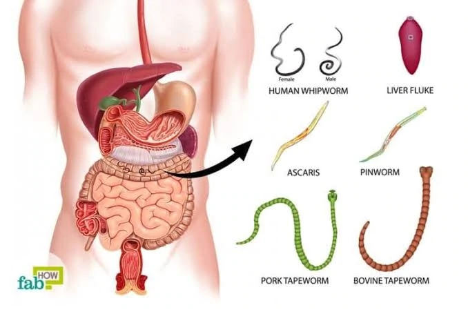 Stomach Parasites Symptoms [and how to get rid of them] – Quit Chronic Fatigue