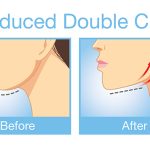 Remove double chin exercises | Remove double chin fast | how to get rid of double chin