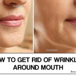 How to Get Rid of Wrinkles Around Mouth?