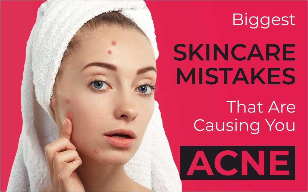 10 Everyday Skincare Mistakes to Avoid for Clearer Skin | Skin Care Routine 30s Acne Prone