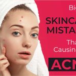 10 Everyday Skincare Mistakes to Avoid for Clearer Skin | Skin Care Routine 30s Acne Prone