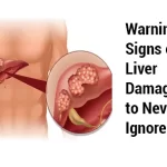 10 Warning Signals of Liver Damage You Should Not Ignore