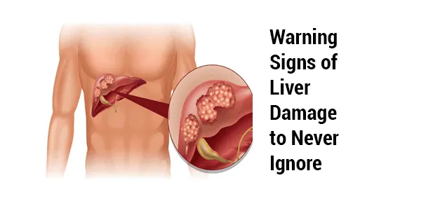 10 Warning Signals of Liver Damage You Should Not Ignore