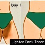 How To Lighten Dark Inner Thighs Naturally