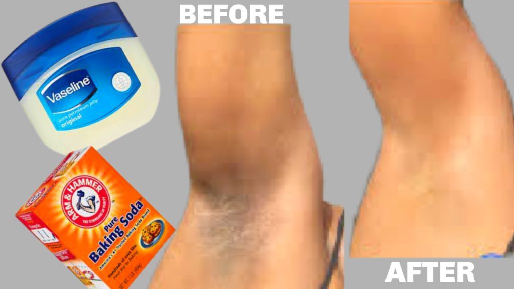 HOW TO LIGHTEN DARK UNDERARMS AND THIGHS IN JUST 3 MINUTES USING BAKING SODA AND VASELINE