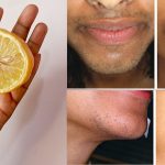 27 Best Remedies To Get Rid Of Facial Hair Naturally