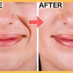 Face Exercises To Get Rid Of Smile Lines