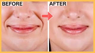 Face Exercises To Get Rid Of Smile Lines