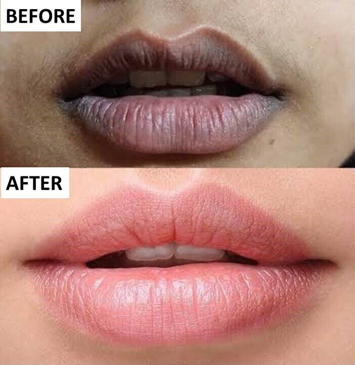 Lip Brightening Cream, Pink Lips Cream, Glow Lip Cream