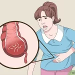 Get Rid Of Pinworms Fast