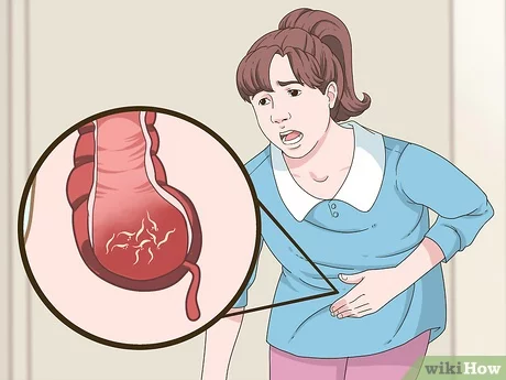 Get Rid Of Pinworms Fast