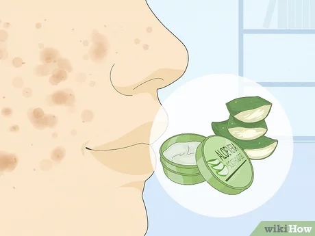 How To Get Clear And Spotless Skin