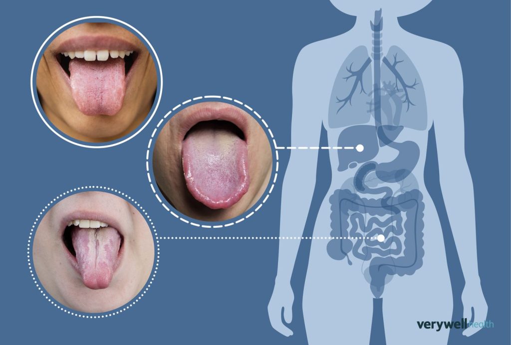 👉What Your Tongue is Trying to Tell You About Your Health👅🌿✨