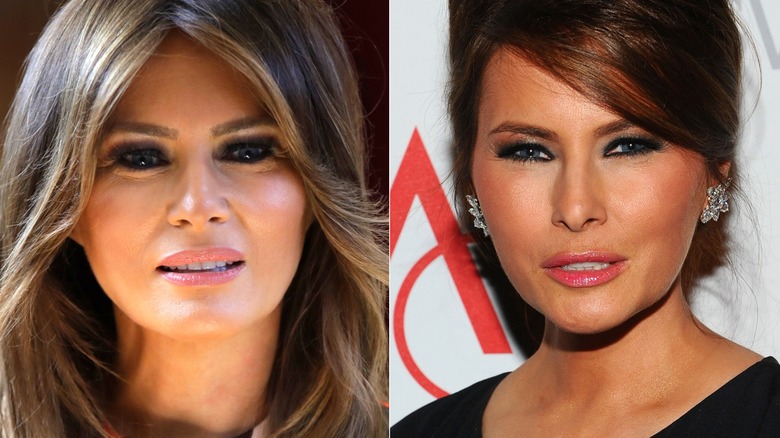 ✨Melania Knauss-Trump’s Skincare Routine: Secrets to Her Timeless Glow🌸💦💖